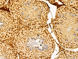 Invitrogen FBXL14 Polyclonal Antibody 100 &mu;L; Unconjugated:Antibodies,