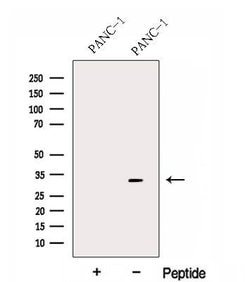 Invitrogen FBXO27 Polyclonal Antibody 100 &mu;L; Unconjugated:Antibodies,