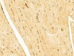 Invitrogen FBXW11 Polyclonal Antibody 100 &mu;L; Unconjugated:Antibodies,