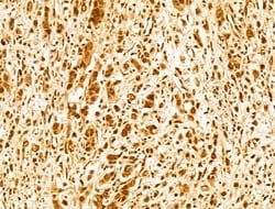 Invitrogen FBXW11 Polyclonal Antibody 100 &mu;L; Unconjugated:Antibodies,