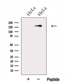 Invitrogen FGD5 Polyclonal Antibody 100 &mu;L | Buy Online | Invitrogen&trade; | Fisher Scientific