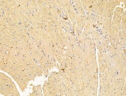 FKBP14 Polyclonal Antibody, Invitrogen 100 &mu;L; Unconjugated:Antibodies,