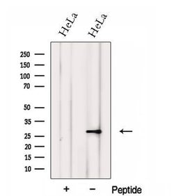 FKBP14 Polyclonal Antibody, Invitrogen 100 &mu;L; Unconjugated:Antibodies,