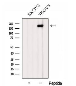 Invitrogen FMN2 Polyclonal Antibody 100 &mu;L | Buy Online | Invitrogen&trade; | Fisher Scientific