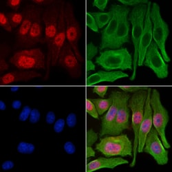 Invitrogen GCHFR Polyclonal Antibody 100 &mu;L; Unconjugated:Antibodies,