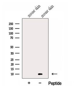 Invitrogen GCHFR Polyclonal Antibody 100 &mu;L; Unconjugated:Antibodies,