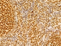 Invitrogen GINS3 Polyclonal Antibody 100 &mu;L; Unconjugated:Antibodies,
