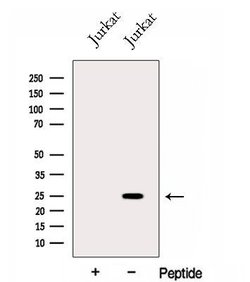 Invitrogen GINS3 Polyclonal Antibody 100 &mu;L; Unconjugated:Antibodies,