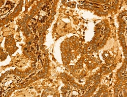 Invitrogen GLTP Polyclonal Antibody 100 &mu;L; Unconjugated:Antibodies,