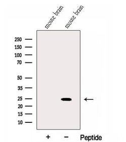 Invitrogen GLTP Polyclonal Antibody 100 &mu;L; Unconjugated:Antibodies,
