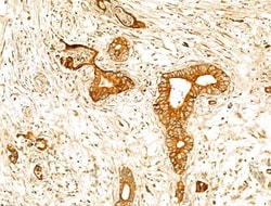 Invitrogen GPX8 Polyclonal Antibody 100 &mu;L | Buy Online | Invitrogen&trade; | Fisher Scientific
