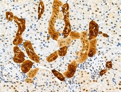 Invitrogen GPX8 Polyclonal Antibody 100 &mu;L | Buy Online | Invitrogen&trade; | Fisher Scientific