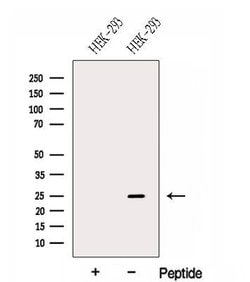Invitrogen GPX8 Polyclonal Antibody 100 &mu;L | Buy Online | Invitrogen&trade; | Fisher Scientific