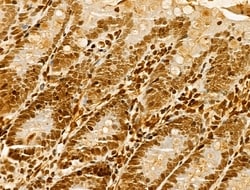 Invitrogen hnRNP H3 Polyclonal Antibody 100 &mu;L; Unconjugated:Antibodies,