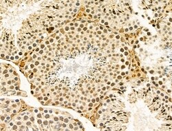 Invitrogen hnRNP R Polyclonal Antibody 100 &mu;L; Unconjugated:Antibodies,