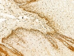 Invitrogen hnRNP R Polyclonal Antibody 100 &mu;L; Unconjugated:Antibodies,