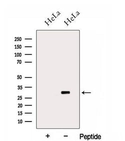 Invitrogen HOXC4 Polyclonal Antibody 100 &mu;L; Unconjugated:Antibodies,