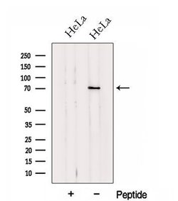 Invitrogen HP1BP3 Polyclonal Antibody 100 &mu;L | Buy Online | Invitrogen&trade; | Fisher Scientific