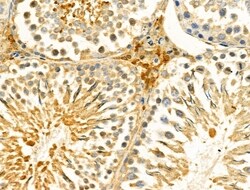 Invitrogen HSDL2 Polyclonal Antibody 100 &mu;L; Unconjugated:Antibodies,