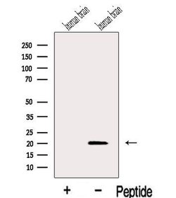 RABL4 Polyclonal Antibody, Invitrogen 100 &mu;L; Unconjugated:Antibodies,