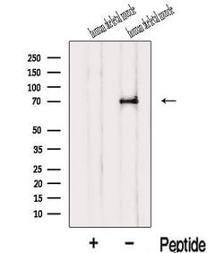 Invitrogen IL1RAPL1 Polyclonal Antibody 100 &mu;L; Unconjugated:Antibodies,