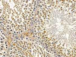 Invitrogen INPP5B Polyclonal Antibody 100 &mu;L; Unconjugated:Antibodies,