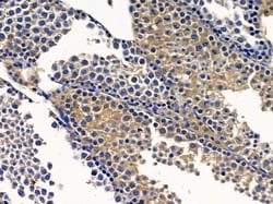 Invitrogen INTS3 Polyclonal Antibody 100 &mu;L; Unconjugated:Antibodies,