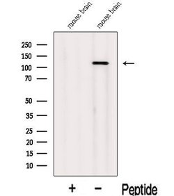 Invitrogen INTS3 Polyclonal Antibody 100 &mu;L; Unconjugated:Antibodies,