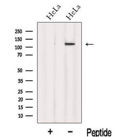 Invitrogen INTS8 Polyclonal Antibody 100 &mu;L; Unconjugated:Antibodies,