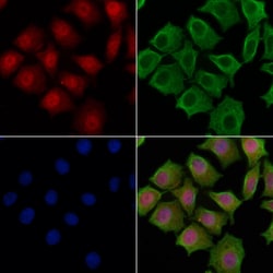 Invitrogen IRF2BP2 Polyclonal Antibody 100 &mu;L; Unconjugated:Antibodies,