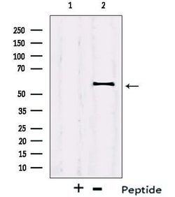 Invitrogen IRF2BP2 Polyclonal Antibody 100 &mu;L; Unconjugated:Antibodies,