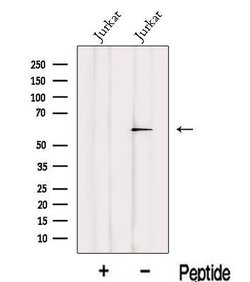 Invitrogen IRF2BP2 Polyclonal Antibody 100 &mu;L; Unconjugated:Antibodies,