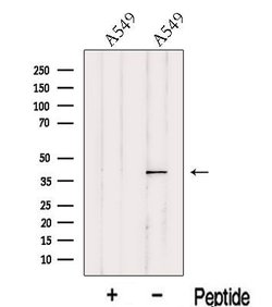 Invitrogen ITM2A Polyclonal Antibody 100 &mu;L; Unconjugated:Antibodies,