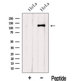 Invitrogen IWS1 Polyclonal Antibody 100 &mu;L | Buy Online | Invitrogen&trade; | Fisher Scientific