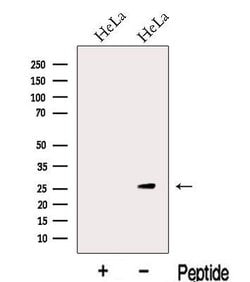 Invitrogen KCTD5 Polyclonal Antibody 100 &mu;L; Unconjugated:Antibodies,