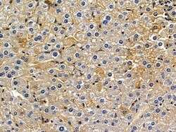 Invitrogen KIF26B Polyclonal Antibody 100 &mu;L | Buy Online | Invitrogen&trade; | Fisher Scientific