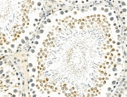 Invitrogen ZNF426 Polyclonal Antibody 100 &mu;L | Buy Online | Invitrogen&trade; | Fisher Scientific