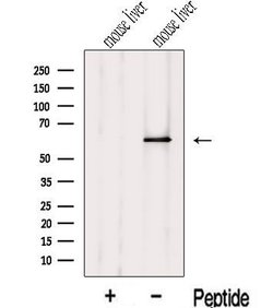 Invitrogen ZNF426 Polyclonal Antibody 100 &mu;L | Buy Online | Invitrogen&trade; | Fisher Scientific