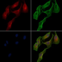 Invitrogen LACTB2 Polyclonal Antibody 100 &mu;L | Buy Online | Invitrogen&trade; | Fisher Scientific