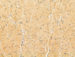 Invitrogen LACTB2 Polyclonal Antibody 100 &mu;L | Buy Online | Invitrogen&trade; | Fisher Scientific