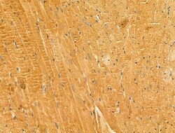 Invitrogen LACTB2 Polyclonal Antibody 100 &mu;L | Buy Online | Invitrogen&trade; | Fisher Scientific