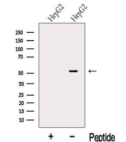 Invitrogen LACTB2 Polyclonal Antibody 100 &mu;L | Buy Online | Invitrogen&trade; | Fisher Scientific