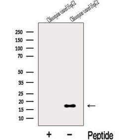 Invitrogen MAP1LC3C Polyclonal Antibody 100 &mu;L; Unconjugated:Antibodies,