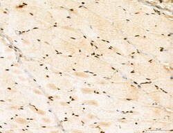 Invitrogen LENG8 Polyclonal Antibody 100 &mu;L | Buy Online | Invitrogen&trade; | Fisher Scientific