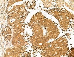 Invitrogen LENG8 Polyclonal Antibody 100 &mu;L | Buy Online | Invitrogen&trade; | Fisher Scientific