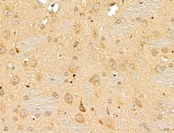 Invitrogen LETM2 Polyclonal Antibody 100 &mu;L | Buy Online | Invitrogen&trade; | Fisher Scientific