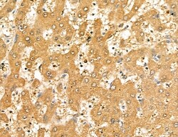 Invitrogen LETM2 Polyclonal Antibody 100 &mu;L | Buy Online | Invitrogen&trade; | Fisher Scientific