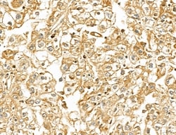 Invitrogen LETM2 Polyclonal Antibody 100 &mu;L | Buy Online | Invitrogen&trade; | Fisher Scientific