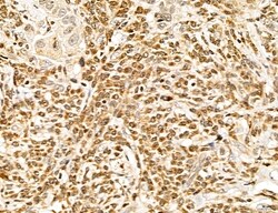 Invitrogen LETM2 Polyclonal Antibody 100 &mu;L | Buy Online | Invitrogen&trade; | Fisher Scientific