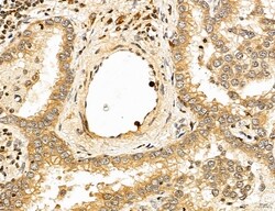 Invitrogen LETM2 Polyclonal Antibody 100 &mu;L | Buy Online | Invitrogen&trade; | Fisher Scientific